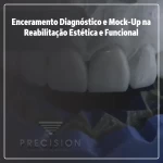 Enceramento Diagnóstico e Mock-Up na Reabilitação Estética e Funcional